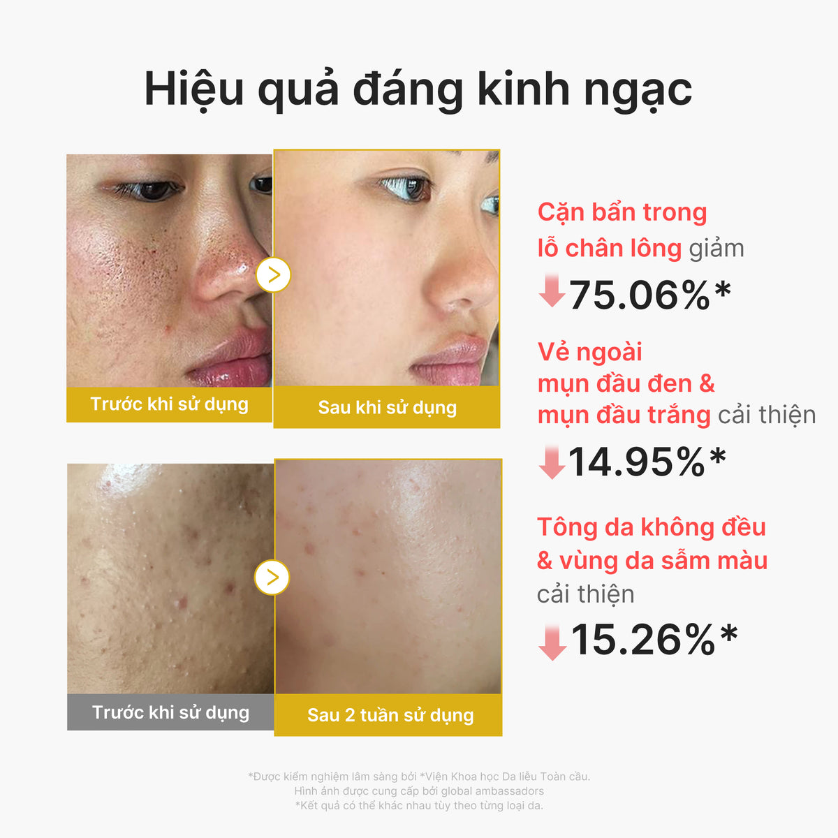 Kojic Acid Turmeric Peel Shot