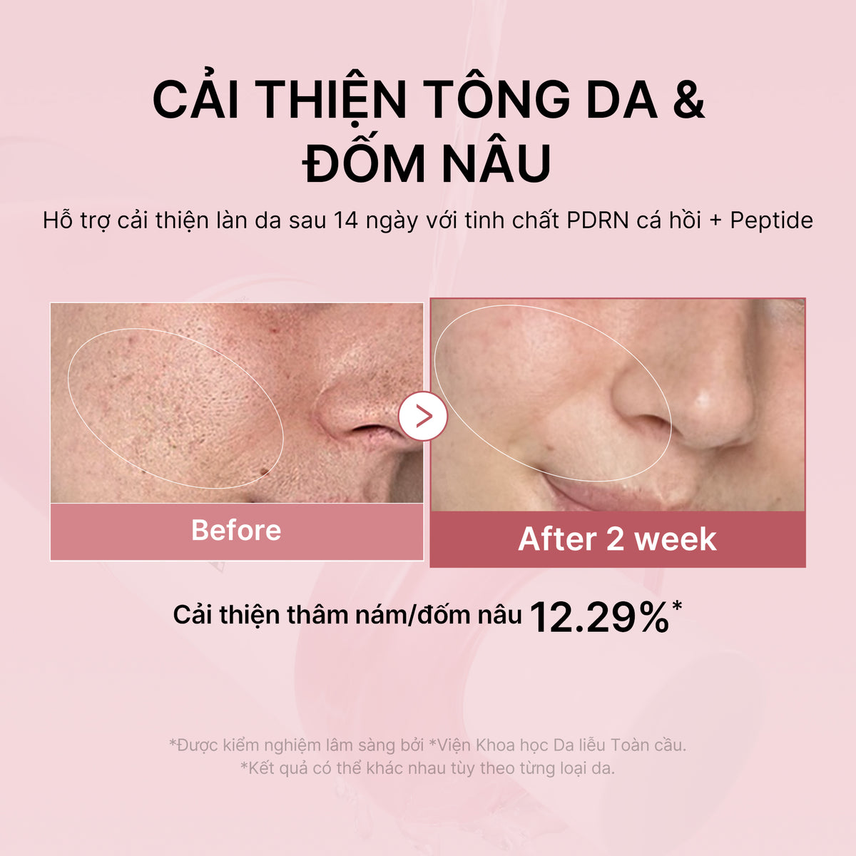PDRN Pink Peptide Toner